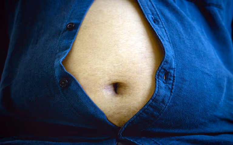 El peso de la obesidad en México, más allá de la fuerza de voluntad 