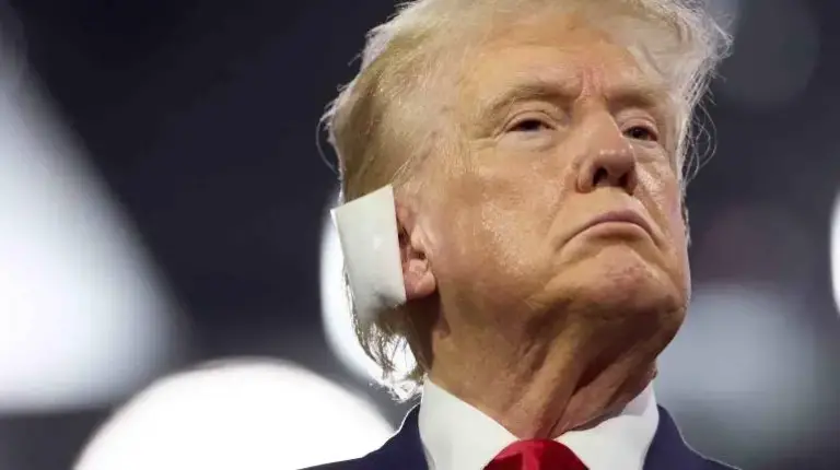 la_bala_estuvo_a_6_milimetros_de_entrar_en_su_cabeza_asegura_medico_de_trump