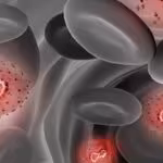 mpox